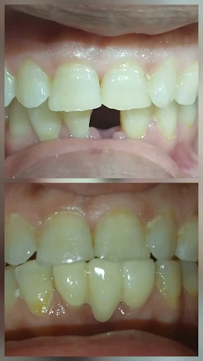 Pooja Smile Care Dental Gallery Image 21